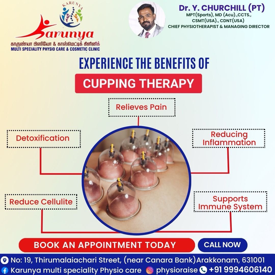 Cupping Therapy